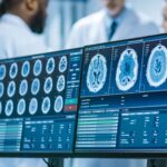 Brain imaging on work screens with background of doctors